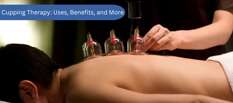 Cupping Therapy