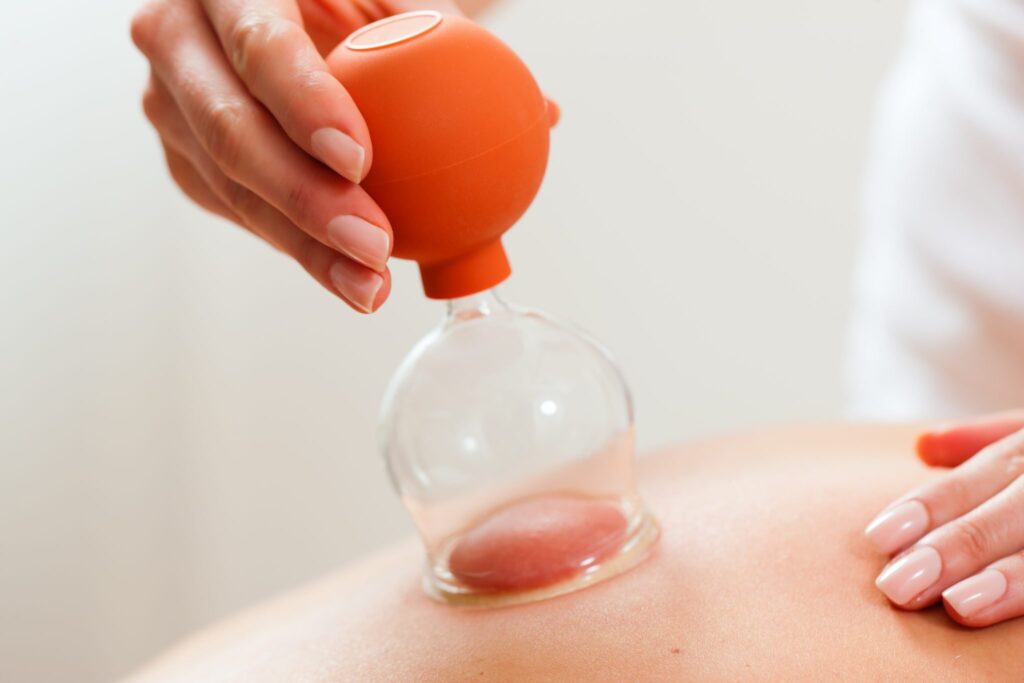 Cupping Therapy Uses, Benefits, and More